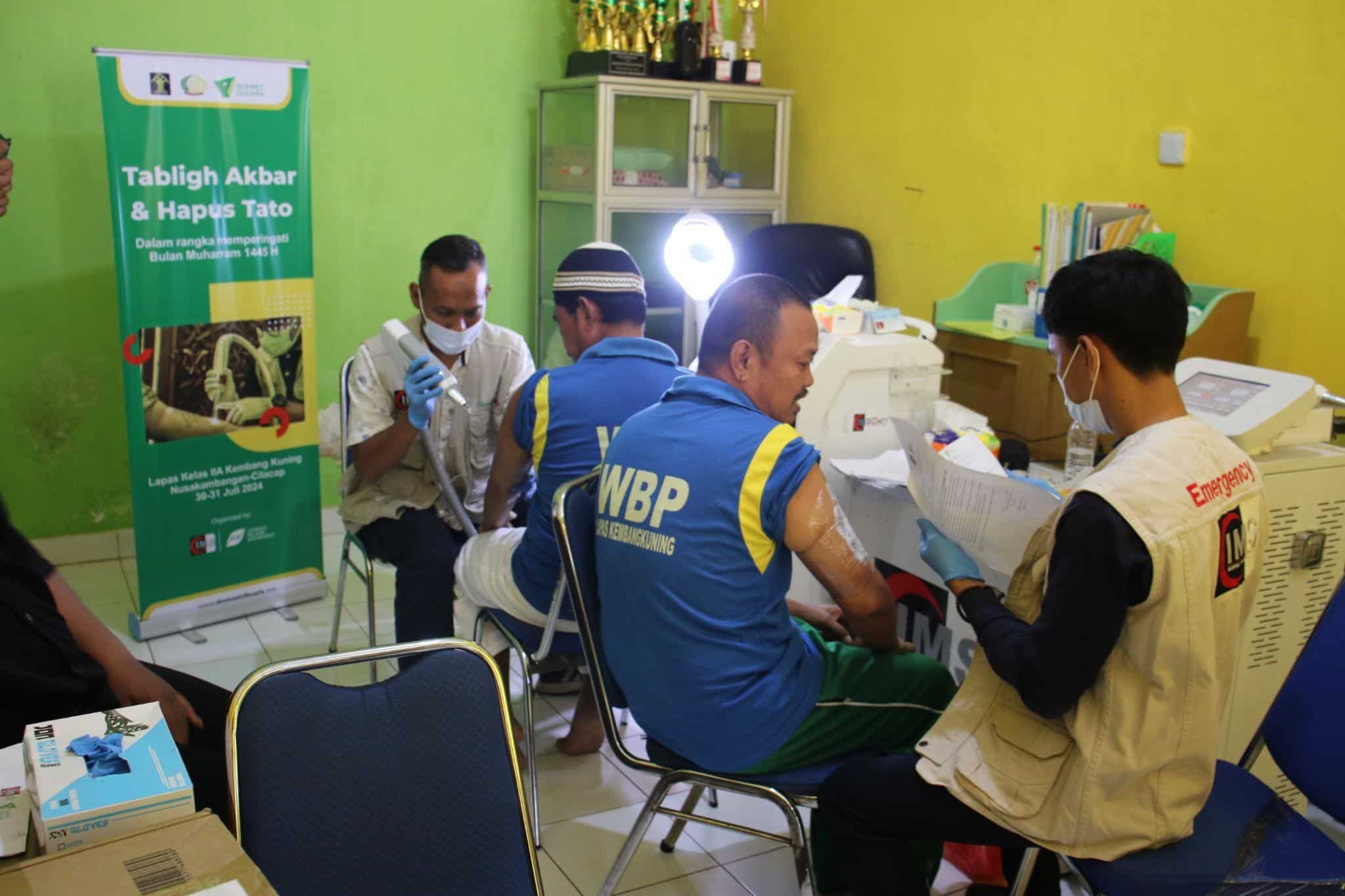 warga binaan hapus tato1 dompet dhuafa Gambar menunjukkan para warga binaan Lapas Kelas II A Kembang, Nusa Kambangan, melakukan hapus tato.