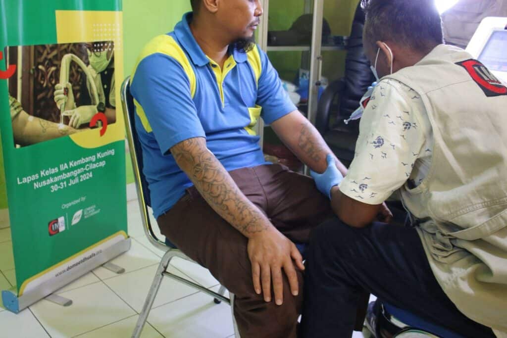 warga binaan hapus tato2 dompet dhuafa Salah satu warga binaan Lapas Kelas II A Kembang akan melakukan hapus tato.