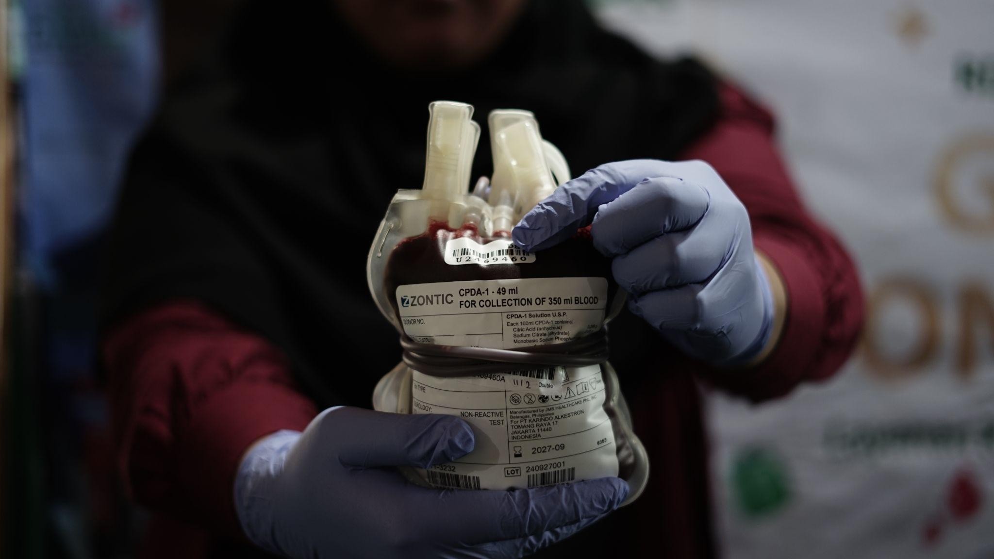 donor darah dompet dhuafa1 dompet dhuafa Kantong darah yang siap didonorkan dari salah satu Insan Dompet Dhuafa melalui program Gerakan Donor Darah (GEDOR) LKC Dompet Dhuafa, pada Selasa (11/2/2025).